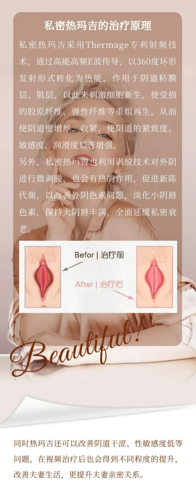 亲闺蜜才会让你去做的私密热玛吉！2.png